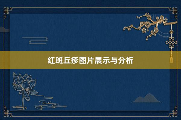 红斑丘疹图片展示与分析